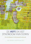 De NIPT en het syndroom van Down - Hans Kröber, Xavier Moonen (ISBN 9789492261939)