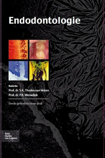 Endodontologie - (ISBN 9789031372478)